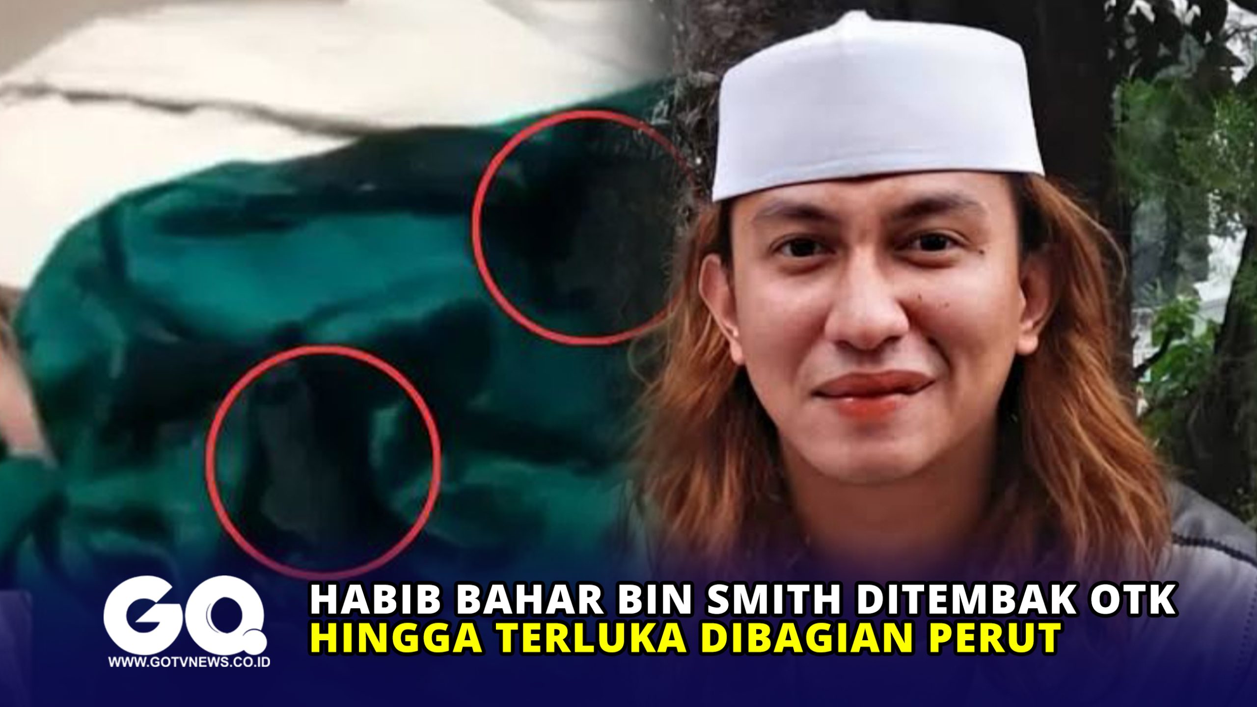 Habib Bahar bin Smith ditembak OTK hingga Terluka dibagian Perut
