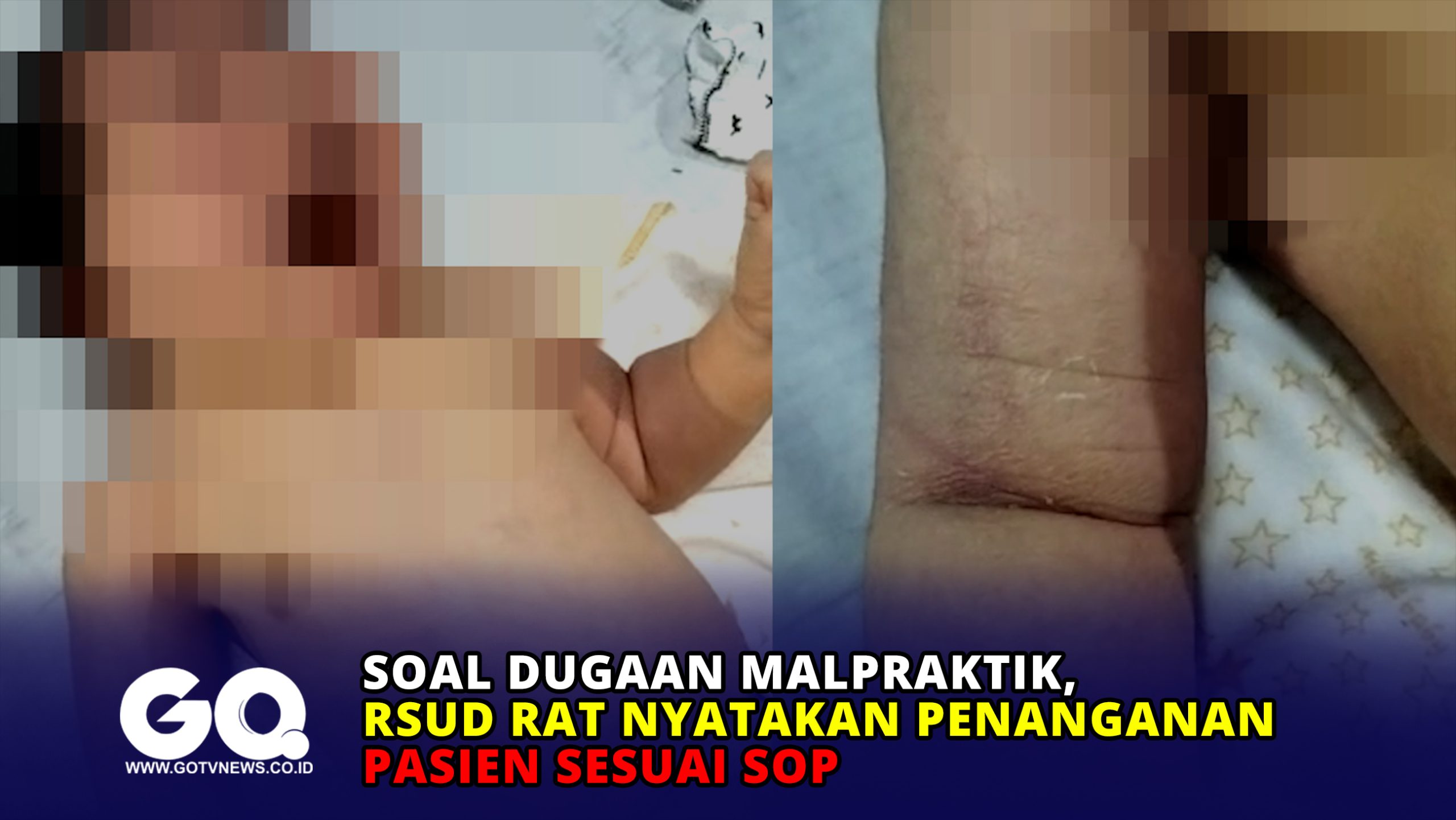 Soal Dugaan Malpraktik, RSUD RAT Nyatakan Penanganan Pasien Sesuai SOP