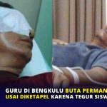 Guru di Bengkulu Buta Permanen usai Diketapel karena Tegur Siswa Merokok