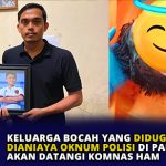 Keluarga Bocah yang Diduga Dianiaya Oknum Polisi di Padang Akan Datangi Komnas HAM