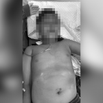 Terlibat Kecelakaan Lalu Lintas, Bocah Laki-Laki Dilarikan ke IGD RSUD Bintan