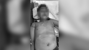 Terlibat Kecelakaan Lalu Lintas, Bocah Laki-Laki Dilarikan ke IGD RSUD Bintan