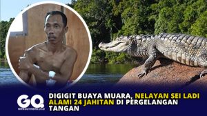 Digigit Buaya Muara, Nelayan Sei Ladi Alami 24 Jahitan di Pergelangan Tangan