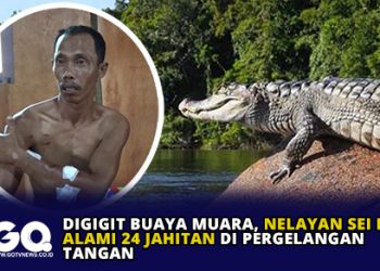 Digigit Buaya Muara, Nelayan Sei Ladi Alami 24 Jahitan di Pergelangan Tangan.