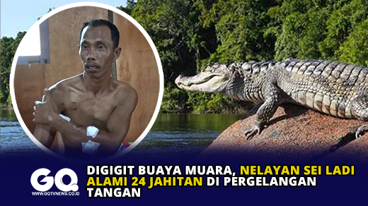 Digigit Buaya Muara, Nelayan Sei Ladi Alami 24 Jahitan di Pergelangan Tangan.