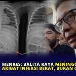 Menkes: Balita Raya Meninggal Akibat Infeksi Berat, Bukan Cacingan