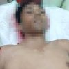 Seorang Pemuda Warga Tanjungpinang Ditemukan Meninggal Dunia, Diduga Akibat Lakalantas di Bintan