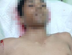 Seorang Pemuda Warga Tanjungpinang Ditemukan Meninggal Dunia, Diduga Akibat Lakalantas di Bintan