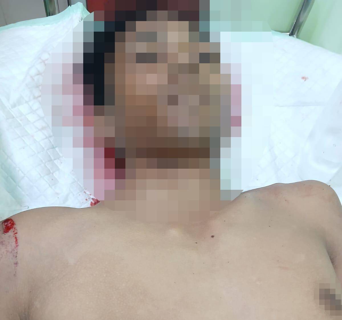 Seorang Pemuda Warga Tanjungpinang Ditemukan Meninggal Dunia, Diduga Akibat Lakalantas di Bintan.