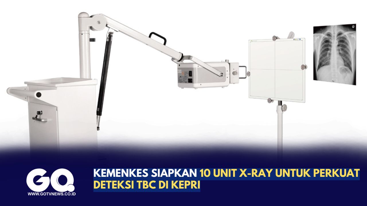 Kemenkes Siapkan 10 Unit X-Ray untuk Perkuat Deteksi TBC di Kepri.